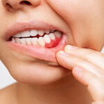 健康歯周病2