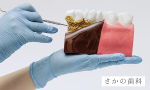 歯周病